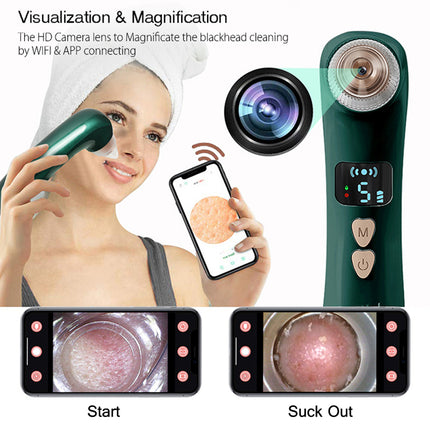 Smart Rechargeable Blackhead Remover