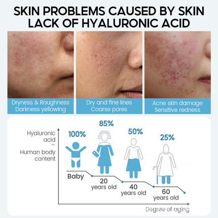 Hyaluronic Acid Stock Solution Serum