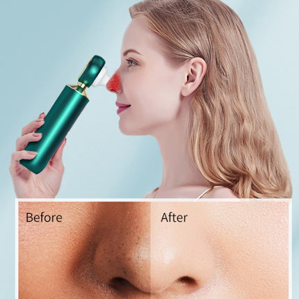 Visual Blackhead Remover with Convex Lens – Ultrasonic Suction Pore Cleaner (Model 826)